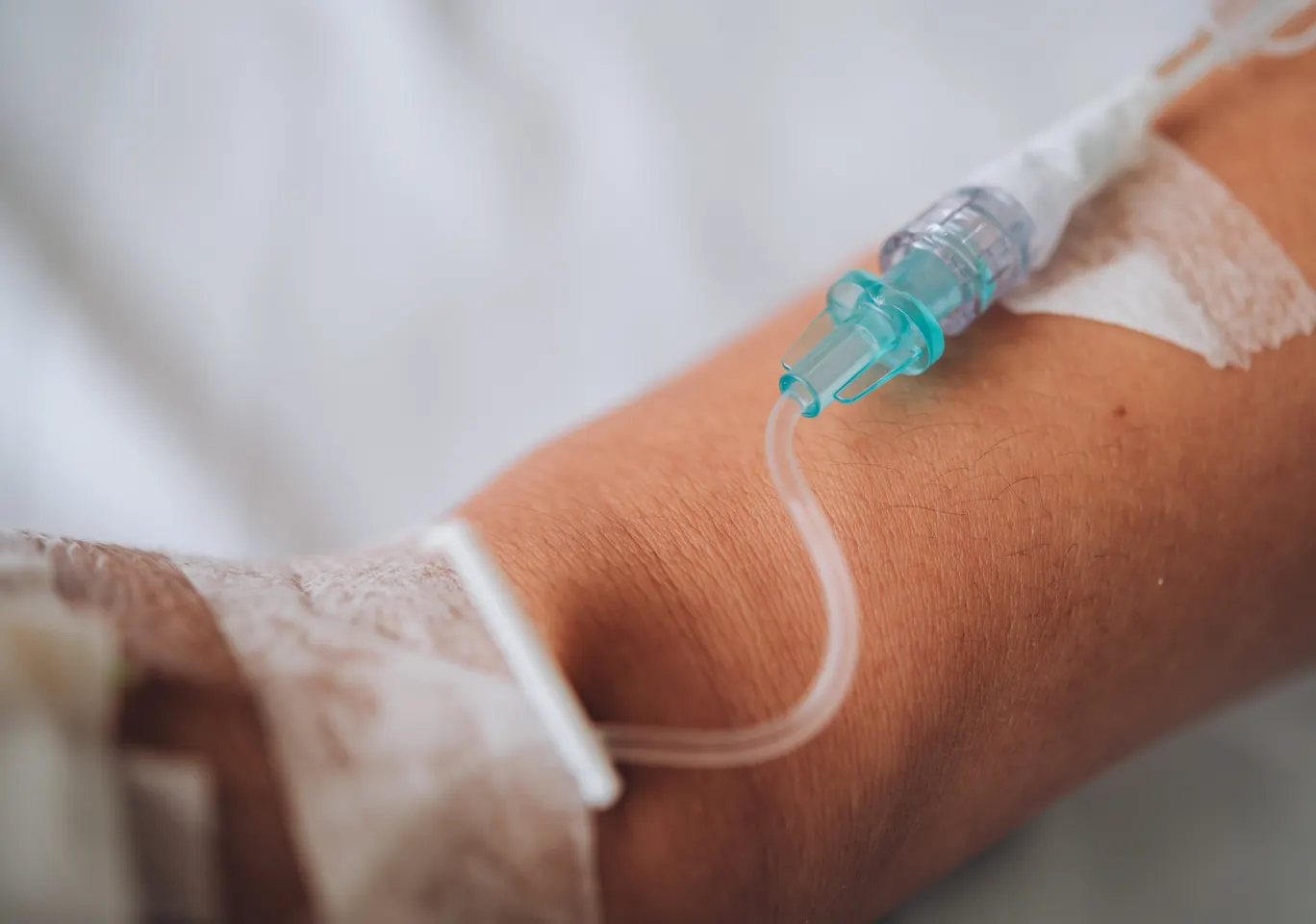 Kroplówki witaminowe Lipsko: wenflon oklejony na przedramieniu podczas wlewu